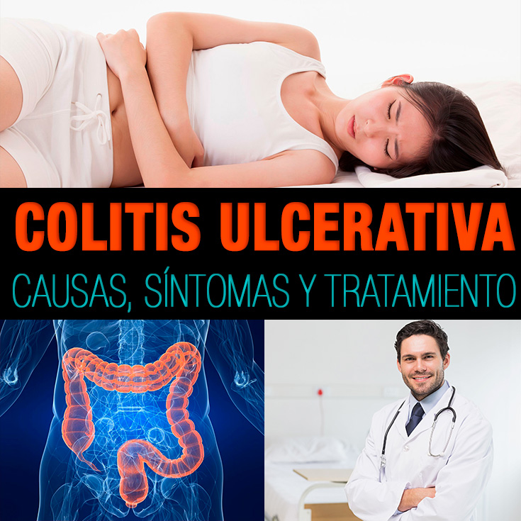 Colitis Ulcerativa Causas, Síntomas Y Tratamiento La Guía de las Vitaminas