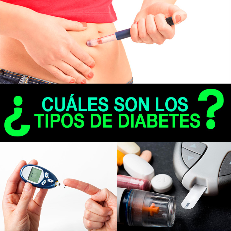 Tipos de Diabetes: Causas, Cómo Identificarlos Y Mucho Más Tipos de Diabetes: Causas, Cómo Identificarlos Y Mucho Más